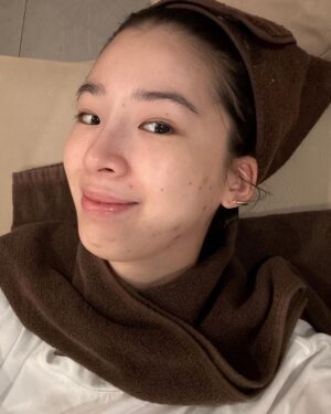 Irene Kim Instagram - Dear pimples,
I’ve noticed recently you’ve been popping up quite frequently. If you’re going to live on my face, I need to see some rent.