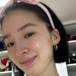 Irene Kim Instagram - Dear pimples, I’ve noticed recently you’ve been popping up quite frequently. If you’re going to live on my face, I need to see some rent.