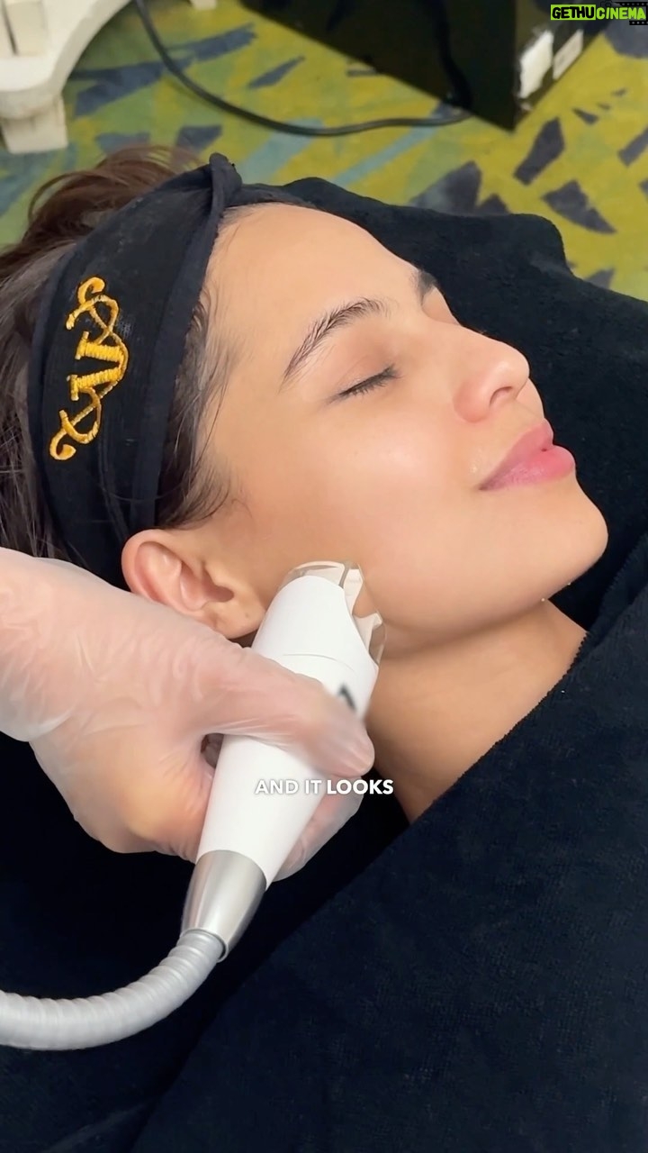 Jasmine Curtis-Smith Instagram - The secret to achieving contoured, lifted, and supple skin is with the Aivee Face Reboot! π Definitely a new favorite of @jascurtissmith πββοΈβ¨ AIVEE FACE REBOOT is a non-invasive procedure that helps lift, firm, and tone the skin while enhancing circulation and lymphatic drainage β
Leaves skin firmer, toned and more supple β
Good for tired, bloated, and stressed skin β
Can be done once a week or once every two weeks DISCLAIMER: Treatments and procedures depend upon consultation. We highly encourage our patients to be examined by our doctors for us to prescribe the proper treatments for your skin and body concern. Treatment costs may be discussed upon consultation. Book your appointment now by calling or sending us a message here! +639177283838 - Local Hotline +639614514572 - International Hotline +639692230499 - Whatsapp/Viber Or you may call our branches at: π A-INSTITUTE, BGC: +63917 521 0222 π FORT, BGC: +63920 966 5529 π MEGAMALL: +63917 871 9500 πVERTIS NORTH: +63917 164 4170 π ALABANG: +63917 537 4200 #aivee #theaiveeclinic #aiveeclinic #aiveeday #aiveelove #aiveeleague #draivee #drzteo #aiveefacereboot