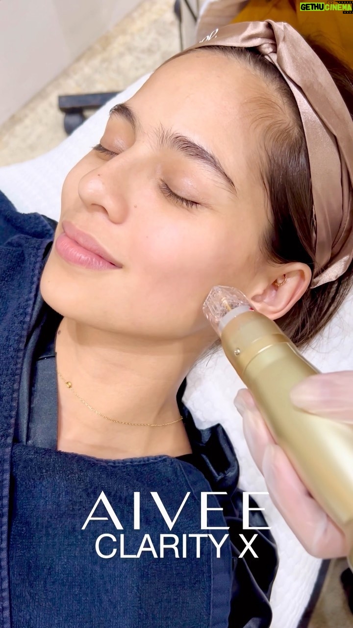 Jasmine Curtis-Smith Instagram - Guess who’s back for another #AiveeDay? @jascurtissmith! First on her agenda is the AIVEE CLARITY X, to help her skin looking firm, tight and rejuvenated! ✨ ✅ AIVEE CLARITY X uses RF technology with micro-needling that treats a wide range of skin problems such as sunspots, age spots, skin texture and tone, and as well as provide skin rejuvenation. DISCLAIMER: Treatments and procedures depend upon consultation. We highly encourage our patients to be examined by our doctors for us to prescribe the proper treatments for your skin and body concerns. Treatment costs may be discussed upon consultation. Book your appointment now by calling or sending us a message here! +639177283838 - Local Hotline +639614514572 - International Hotline +639692230499 - Whatsapp/Viber Or you may call our branches at: 📍 A-INSTITUTE, BGC: +63917 521 0222 📍 FORT, BGC: +63920 966 5529 📍 MEGAMALL: +63917 871 9500 📍VERTIS NORTH: +63917 164 4170 📍 ALABANG: +63917 537 4200 #aivee #theaiveeclinic #aiveeclinic #aiveeday #aiveelove #aiveeleague #aiveeclarityx #clearskin #brightskin #brightcomplexion #evenskintone #jasminecurtis #draivee #drzteo #reels #igreels The A Institute, BGC Fort