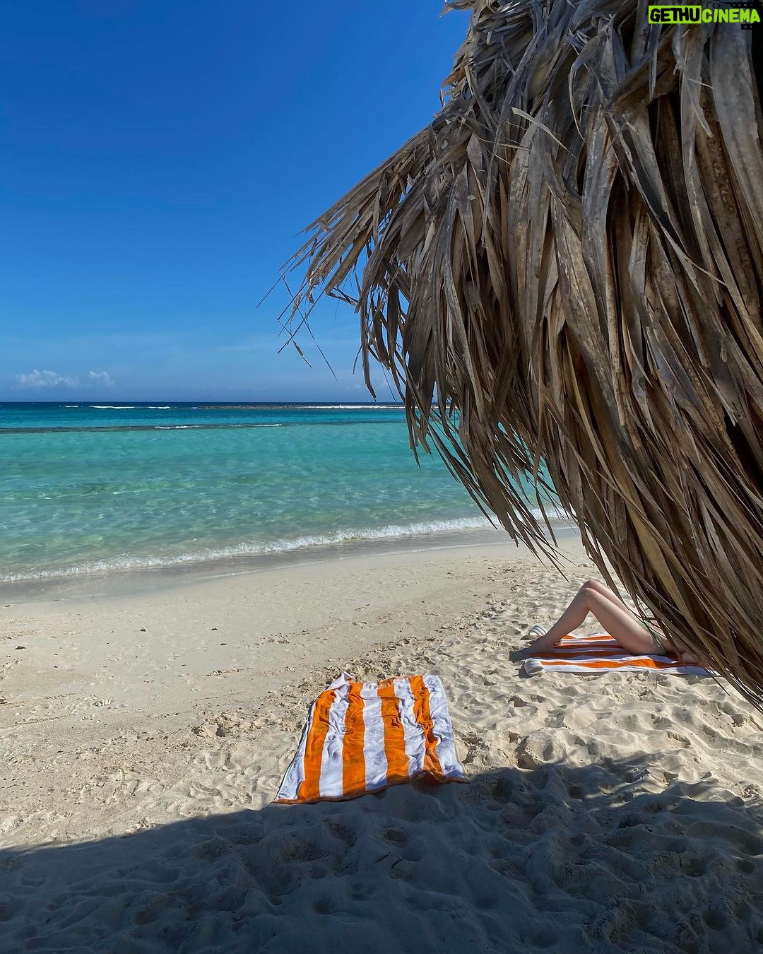 Jenn McAllister Instagram - sunburnt Aruba