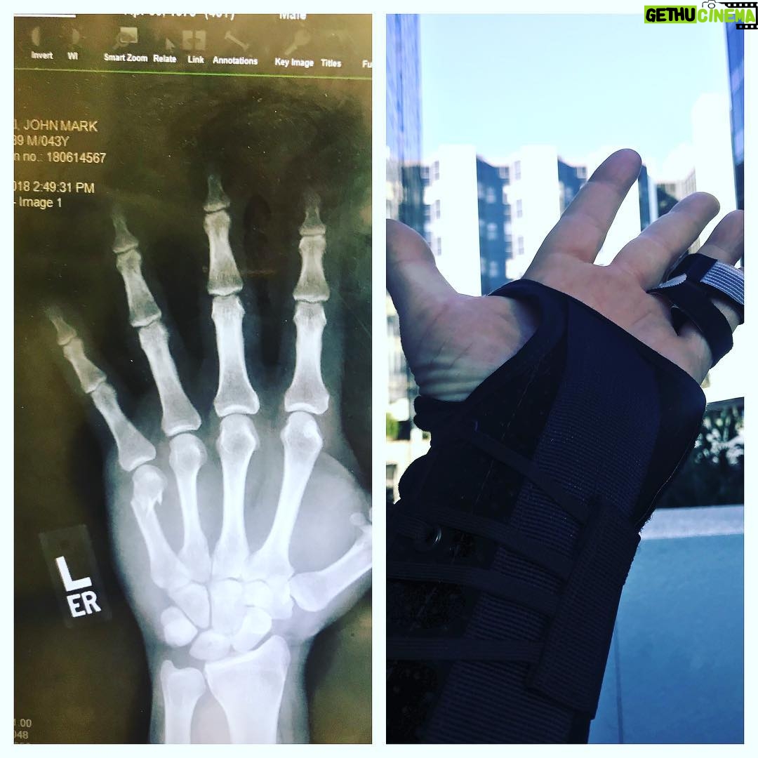 Johnny Galecki Instagram - Not the worst day but could have been better. Thanks to those at Cedar-Sinai Medical. #youshouldseetheotherguy