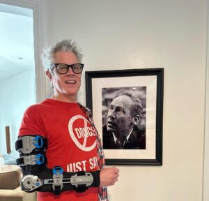 Johnny Knoxville Instagram - Thanks to Dr. E. for fixing my right arm good as new. At the end of 2022 I tore part of my right bicep off the bone and had to go in two weeks ago to get it all sewn back together. Will be another month before I am out of this Tron like brace but  it’s not so bad. Plus I kind of like the look of it.🤸🏻‍♀️