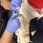 Johnny Knoxville Instagram - Thanks to Dr. E. for fixing my right arm good as new. At the end of 2022 I tore part of my right bicep off the bone and had to go in two weeks ago to get it all sewn back together. Will be another month before I am out of this Tron like brace but it’s not so bad. Plus I kind of like the look of it.🤸🏻‍♀️