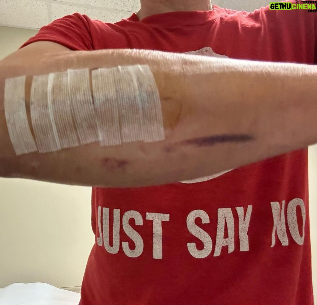 Johnny Knoxville Instagram - Thanks to Dr. E. for fixing my right arm good as new. At the end of 2022 I tore part of my right bicep off the bone and had to go in two weeks ago to get it all sewn back together. Will be another month before I am out of this Tron like brace but it’s not so bad. Plus I kind of like the look of it.🤸🏻‍♀