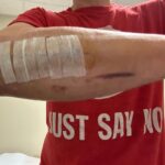 Johnny Knoxville Instagram - Thanks to Dr. E. for fixing my right arm good as new. At the end of 2022 I tore part of my right bicep off the bone and had to go in two weeks ago to get it all sewn back together. Will be another month before I am out of this Tron like brace but it’s not so bad. Plus I kind of like the look of it.🤸🏻‍♀️