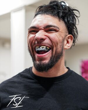 Johnny Walker Instagram - Crazy 24K gold mouthguard for @johnnywalker 

@mouthguardshop 
@johnnywalker 
@mouthguardshop 

#fse #fsent #boxing #vegas #photography #photographer #ufc #ufc300