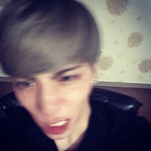 Jonghyun Instagram - 프락셀했저니 주근깨같이 멍듬 올....