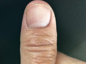Josh Brolin Instagram - For my Only Fans. Just started a page for all those interested. I was told I could make a ton a money posting body parts. This is one of them. I think it's my thumb. I think. Subscribe now, and I'll send you a close up of the nail for free! www.onlyfansjbdirtythumb.com