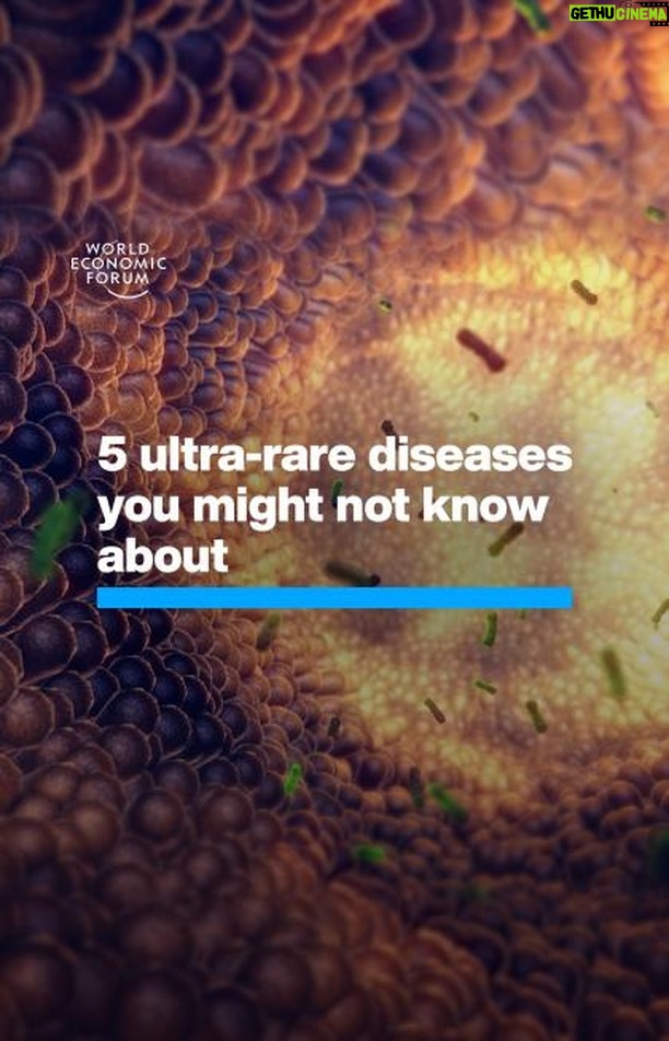 Klaus Schwab Instagram - Globally, an estimated 263-446 million people live with a rare disease. Learn more in the latest health news from the World Economic Forum's Centre for Health and Healthcare by tapping on the link in our bio. #RareDiseaseDay