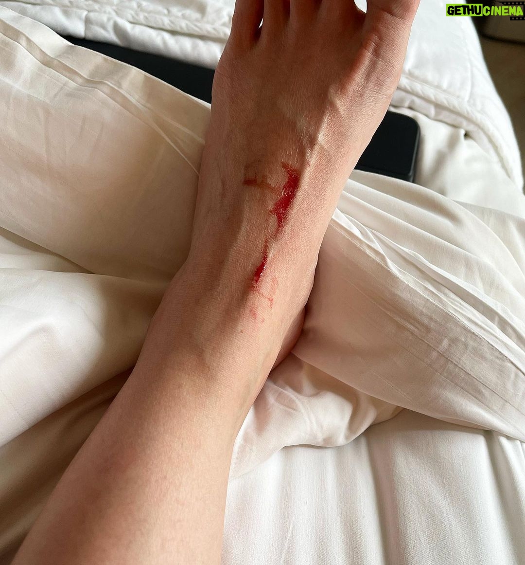 Kris Aquino Instagram - My regular blood tests are done either by Cardinal Santos or Medical City... it’s weird because majority of my doctors in the 🇵🇭 practice in St Luke’s Global or Asian- but because of where we used to live (Greenmeadows in QC), alvin befriended the people in the laboratory departments in the 2 nearby hospitals & it’s safe to say 75% of my blood work ups are still done by staff from Medical City. My doctors asked me to have my blood panel done to reassure all of us that i’m healthy enough to travel for my beach wellness break because we’re going somewhere that doesn’t have access to the same type of facilities that the hospitals i mentioned have. Do not swipe to the last picture if you are squeamish about blood- i think this was Sunday, i soaked in the tub, put my diluted essential oils, and pasensya na kung weird- nag obey, nag lagay ng malaking uncut rose quartz BECAUSE it’s supposed to help the skin heal (apart from losing my voice, i had an urticaria flare)... dagdagan na natin ang masamang dulot ng too much googling, my nurse was also playing the Tibetan singing bowl para daw mawala ang lahat ng negativity so i’ll “heal” faster. So i got out after 15 minutes, nag shampoo, used a mild shower foaming cleanser, then got out to dry myself- oh my, my left foot was covered in blood. i swear, i didn’t feel kung nagasgas or tumama sa rose quartz, i also didn’t notice anything was wrong when i was in the shower. We showed my doctor & i missed daw the vein by less than 1/2 an inch or else nasa ER na ko. This pic was already after nalinis yung cuts with CUTASEPT but before the FUCIDIN. Moral of the story- awat na muna sa rose quartz & tigilan ko na muna yung mga Tibetan singing bowls... Start na ng Year of the Ox- here’s to a healthier year for all of us. See you tonight, LIVE here on FB at 7 PM for my @shopee_ph #lovelovelove & matchmaking event. Shangri-La The Fort, Manila