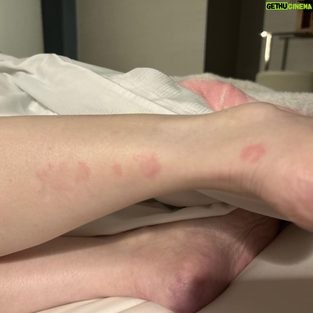 Kris Aquino Instagram - i chose not to share with you until now that Bimb had fever starting on Saturday night, July 8. It started as a bad cough & sore throat. Monday, July 10, Dr. Henry our Fil-Am friend who thankfully has been so kind to me & my sons came by to check on bimb… i felt my heart crumble because bimb from Dr Henry’s assessment had pneumonia. 3rd time na for bimb- his 2nd bout w/ pneumonia happened during the initial pandemic lockdown when we were in Puerto Galera March 2020. My bunso has had asthma since he was 9. But as a baby all the way until he was in grade 1 bimb suffered from skin asthma and from childhood til now he has many of my environmental allergies. It was the worst feeling in the world as most parents would agree, when your family doctor says you aren’t allowed to go near your son and help take care of him because you’re undergoing immunosuppressant therapy using chemotherapy medication. Thank God bimb’s kuya josh stubbornly refused to leave the connecting room where bimb had to stay. He was bimb’s constant companion & even though my nurses kept telling kuya to stop hugging bimb tuloy pa rin sya. Thank God matibay kuya’s resistance, hindi sya nahawa ng kahit ubo o sipon. Lemuel is both a nurse and phlebotomist his business is to do home service blood extraction. He did my blood extraction Tuesday, July 12. Bimb finished his prescription Saturday & he’s 90% recovered. My lead doctor from UCLA, Dr John Belperio had my results Wednesday and he has the best, most positive outlook even when he’s giving bad news. i’ll try to explain my current situation without using too many medical terms. They’ll be in art cards along with some pics to help you understand where i am health wise and what a long battle i have… 1 thing is very clear to me- buhay ako ngayon dahil hindi kayo nagsasawang isama ako sa prayers ninyo even though most of you have never even met me in person. And that’s why i owe you only the TRUTH.