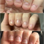 Lele Pons Instagram - After 25 years of biting my nails due to anxiety and OCD i finally quit! Those who have this bad habit know how hard it is to stop. Hopefully this post encourages those who are struggling with this habit to stop, and not feel so alone. It’s been 2 months and so far i have not broken my goal😊 if you take care of your mental health and make it a priority to better yourself, you will overcome many obstacles 🙏🏼❤️ Después de 25 años de morderme las uñas debido a la ansiedad y el TOC, ¡finalmente lo dejé! Quienes tienen este mal hábito saben lo difícil que es dejarlo. Esperemos que esta publicación anime a aquellos que están luchando con este hábito a dejarlo y no sentirse tan solos. Han pasado 2 meses y hasta ahora no he superado mi objetivo 😊 si cuidas tu salud mental y haces de tu salud mental una prioridad para superarte, superarás muchos obstáculos 🙏🏼❤️