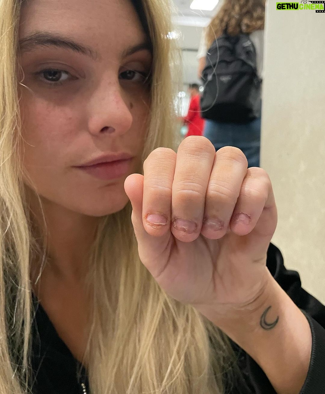 Lele Pons Instagram - After 25 years of biting my nails due to anxiety and OCD i finally quit! Those who have this bad habit know how hard it is to stop. Hopefully this post encourages those who are struggling with this habit to stop, and not feel so alone. It’s been 2 months and so far i have not broken my goal😊 if you take care of your mental health and make it a priority to better yourself, you will overcome many obstacles 🙏🏼❤️ Después de 25 años de morderme las uñas debido a la ansiedad y el TOC, ¡finalmente lo dejé! Quienes tienen este mal hábito saben lo difícil que es dejarlo. Esperemos que esta publicación anime a aquellos que están luchando con este hábito a dejarlo y no sentirse tan solos. Han pasado 2 meses y hasta ahora no he superado mi objetivo 😊 si cuidas tu salud mental y haces de tu salud mental una prioridad para superarte, superarás muchos obstáculos 🙏🏼❤️