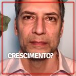 Luís Ernesto Lacombe Instagram - O crescimento do Brasil está ameaçado. A solução seria seguir o que fizeram os países mais desenvolvidos do mundo... Só que o Lula finge que a salvação está no tal Estado indutor, no Estado gastador. #canaldolacombe #canalluisernestolacombe #lacombe #luisernestolacombe #youtube #jornalismo #jornalista #pib #estagnação #Estado #gastança #capitalprivado