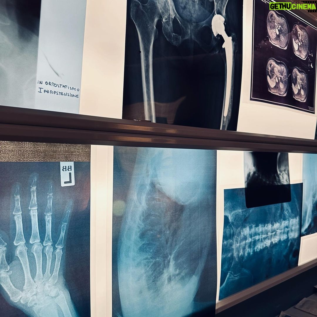 Luca Argentero - 129K Likes - Dettagli di scenografia…
“Non sto piangendo, mi è solo caduta un’Alba in un occhio…” cit.
#Doc3 #workinprogress
