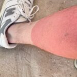 Macklemore Instagram – At least I got built in socks for the next year 🤷🏼‍♂️🫠… Can anyone relate? #neverwearingshortsagain