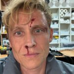 Matthias Schweighöfer Instagram - That escalated quickly ... on set 😉 Our make-up artists did a great job for our current film shoot Das ist eskaliert ... am Set 😉 Unsere Make-up Artists machen einen tollen Job beim aktuellen Filmdreh