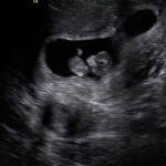 NF Instagram - Bringing a human into this world. I’m going to be a dad. The end.