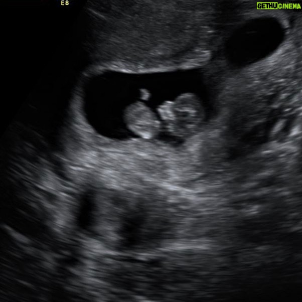 NF Instagram - Bringing a human into this world. I’m going to be a dad. The end.