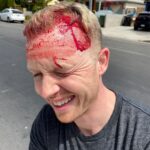Noel Fisher Instagram - Helping a friend move this weekend and...may have bumped my head. The lesson here is don't help anyone ever...or, ya know, maybe look where you're going. 😂 PS Don't worry, I'm all good. Head wounds bleed a lot even when they're not bad.