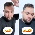 Oussama Ramzi Instagram – الكلمات كاعيين و اللحن ما قاداه فرحة 😂
