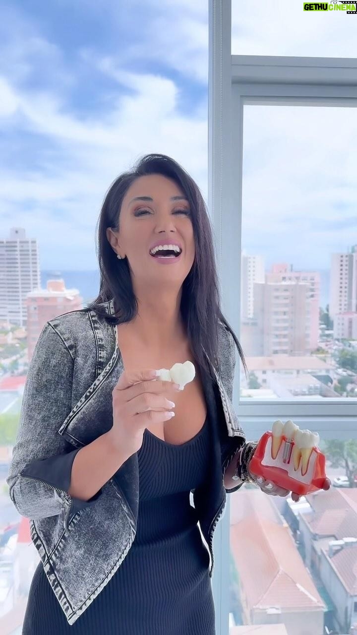 Pamela Díaz Instagram - En Clínica Montblanc nos convertimos en especialistas en implantes dentales y les tenemos una oferta para celebrar! 🦷 50 cupos para implante diente dental unitario a $500.000!! (v/s $649.990 😱) No se lo pueden perder. Agenden su hora de evaluación sin costo con el especialista! Nos vemos en Montblanc, LA CLÍNICA de Viña del Mar! Agenda por DM o ☎️ +56 32 217 9246 📱 +56 9 4997 5189 Que no te lo cuenten ! Viña del Mar, Quinta Región