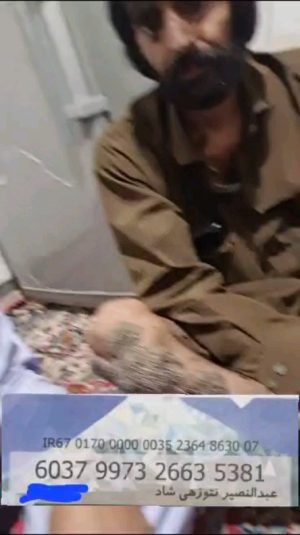 Parviz Parastouei Instagram - .
امروز روز پزشک است
روز  همگیِ شما مبارک که به انسان ها و حتی حیوانات هم جان می بخشید
چه شغل مقدسی 
همگیتان باعث افتخار هستید
بزرگواران 
این عزیزی که در این فیلم می بینید نامش عبدالنصیر است
یک ایرانی
یک هموطن بلوچستانی 
کافیست یک لحظه خودمان را جای او بگذاریم 
بدون شک حتی یک نفر حاضر نیست یک ثانیه جای عبدالنصیر باشد
متاسفانه ایشان روزگار سختی را می‌گذراند 
نیاز مبرم به کمک دارد 
هر پزشکی 
هر انسانی که می‌تواند در بهبودی عبدالنصیر سهیم باشد 
دریغ نکند
آرزوی سلامتی برای عبدالنصیر عزیز هموطن بلوچ