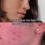 Paula Gonu Instagram – tener la piel sensible con imperfecciones lo complica todo pero se puede✨ uso @avene desde mi primer chequito con 12 años (cuando no he sido constante se ha notado) y amo su nuevo serum🫠 
 
#CleananceSerum #Cleanance #EficaciaCleanance publi