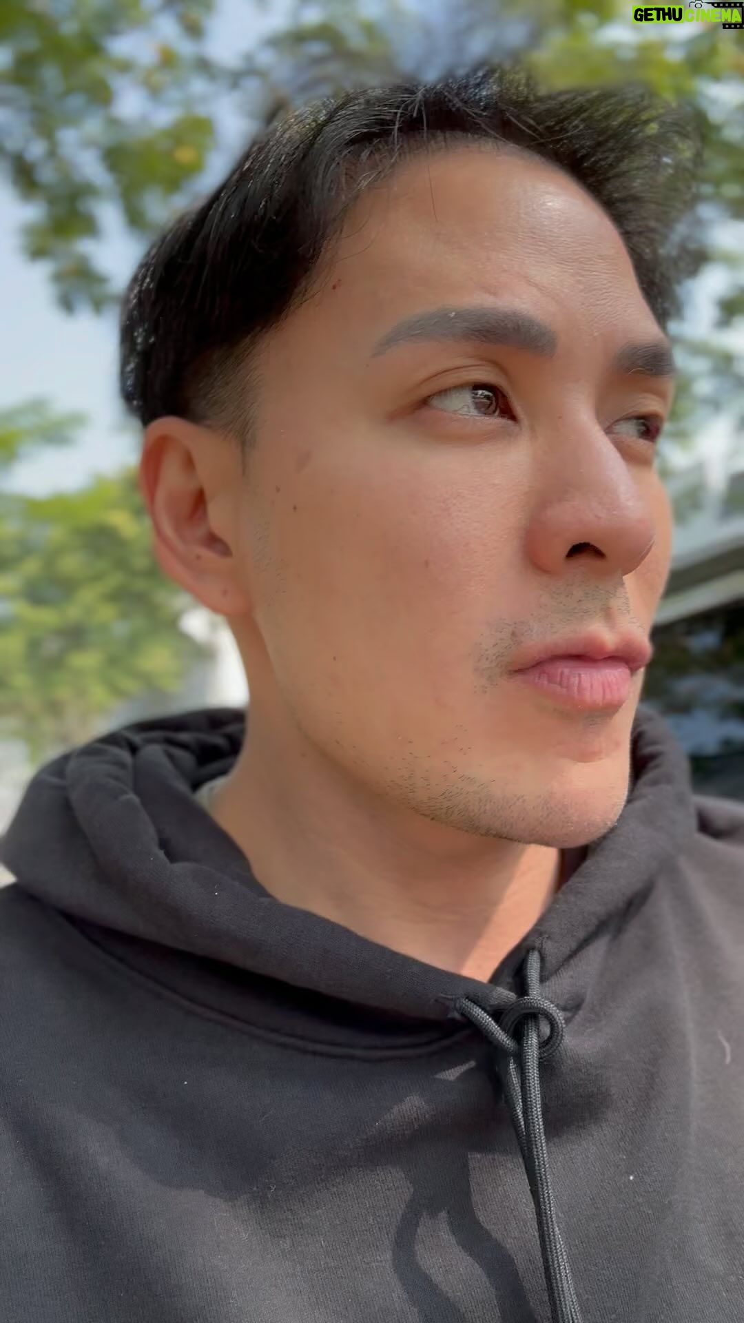 Pharanyu Rojanawuttitham Instagram - มายิงหนวดนะ @lumiluxclinic นึกว่าจะเจ็บ นอนฟังเรื่องผีสบายเลย 🤭🤭🤭#สบายๆ
