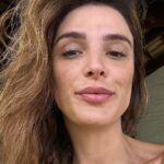 Rafa Brites Instagram - Pele real, tem poro, tem mancha tem umas bolinhas…. E no verão , sol e todas as comilanças ela fica mais louca ainda.