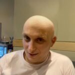 Raphaël Carlier Instagram - Trop bien fait le filtre chauve !