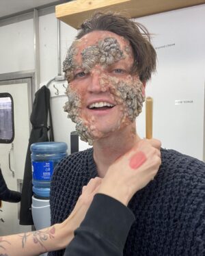Richard Harmon Instagram - Thanks to everyone involved with @thegooddoctorabc for having me tonight, working with all of you was a delight. It’s a rarity for me to play a beacon of positivity like Eddie, he was truly a pleasure. 
Special shout out to our Director Gary Hawes and the unbelievable make up team at @mastersfxstudios, you shouldered so much of the transformation that Eddie was.