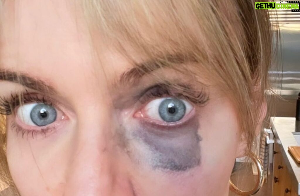 Rob McElhenney Instagram - Well it’s the first day of shooting so, of course, the lady of the house ran into a wall. Thank god for @theadorable1 and her makeup team for making it going away…. 🙄