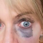 Rob McElhenney Instagram - Well it’s the first day of shooting so, of course, the lady of the house ran into a wall. Thank god for @theadorable1 and her makeup team for making it going away…. 🙄