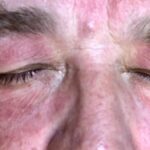 Russell Crowe Instagram - The Actor endures ... 5 months of prosthetics. 2 make up applications to go... Skin care = discipline. From an actors perspective a character like Roger Ailes is a gift... but the physical and mental battle has been intense. The glow some see on my skin is actually damage.
