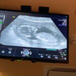 Sabrina Seara Instagram – Tenemos noticias 🤭🤭🤭🤭
Esta familia no puede estar más feliz ,
 Maxi será ascendido a hermano mayor en Julio . 

Gracias a todo el equipo @hola_mx y a nuestros cómplices que hicieron posible esta sorpresa! 

 Más de 4 meses de amor ❤️

#noseaslocachica #prontoseremos4 
#holamexico #pregnancyannouncement #pregnancyphotoshoot