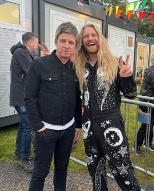 Sam Ryder Instagram - Had some surgery to remove a lump above my eye (should be all good though, nothing to worry about 🙏) anyway, the best medicine was a weekend full of music with my pals and singing my head off with you all! 

Ps. sorry for jumping around, Doc 🤕 

📸 @__jackrobinson__