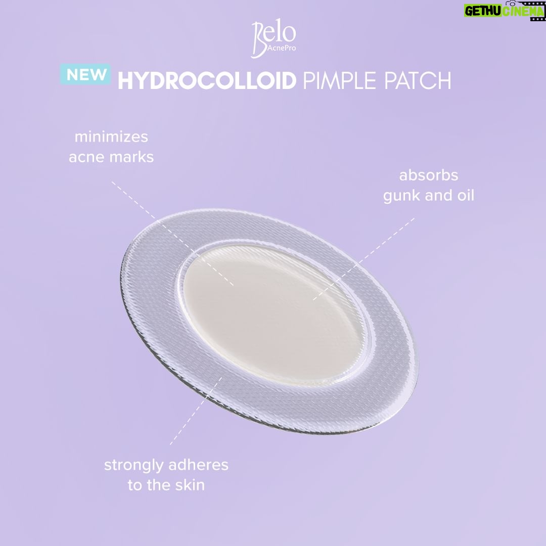 Sarah Geronimo Instagram - Pimple emergency? π Don't stress! Meet the NEW #BeloAcnePro Hydrocolloid Pimple Patch β my new fave for acne care! π It effectively absorbs pus from pimples to quickly flatten them, while preventing acne marks. π€ I-try niyo na rin and say goodbye to pimples! ππΌ @beloacnepro