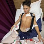 Sascha Burci Instagram - Beh, inizia bene questo 2023! Sono ormai quasi 3 anni dal momento in cui ho iniziato il mio viaggio di miglioramento fisico con palestra e dieta. Dopo tutto questo tempo però ho dovuto fare i conti con i 10 anni dove non ho fatto sport, ne attività fisica… Per colpa di questo lungo menefreghismo non potevo raggiungere il risultato fisico che avevo fisso in mente. Dopo aver consultato Personal Trainer, Nutrizionisti e Medici, la risposta purtroppo è stata sempre la stessa: “l’ultima parte di addome, fianchi e lombari non puoi toglierla. Questo adipe localizzato puoi toglierlo solo con la chirurgia estetica.” (nel mio caso). Psicologicamente non riuscivo ad accettare di non potermi vedere bello come desideravo dopo tutti questi sforzi per raggiungere il mio obiettivo. Dopo varie riflessioni mi sono deciso ed eccomi qua, ancora gonfio post operazione ma felice di poter raggiungere il mio risultato desiderato e di poter dire addio ai brutti pensieri che mi turbavano da tempo. Grazie a @cygnusclinic per avermi aiutato in questo sogno e di avermi assistito in tutto! Ora diventerò il vero Dio Greco che tanto ho desiderato 🤍 #suppliedbycygnusclinic Istanbul, Turkey