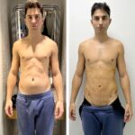 Sascha Burci Instagram - Beh, inizia bene questo 2023! Sono ormai quasi 3 anni dal momento in cui ho iniziato il mio viaggio di miglioramento fisico con palestra e dieta. Dopo tutto questo tempo però ho dovuto fare i conti con i 10 anni dove non ho fatto sport, ne attività fisica… Per colpa di questo lungo menefreghismo non potevo raggiungere il risultato fisico che avevo fisso in mente. Dopo aver consultato Personal Trainer, Nutrizionisti e Medici, la risposta purtroppo è stata sempre la stessa: “l’ultima parte di addome, fianchi e lombari non puoi toglierla. Questo adipe localizzato puoi toglierlo solo con la chirurgia estetica.” (nel mio caso). Psicologicamente non riuscivo ad accettare di non potermi vedere bello come desideravo dopo tutti questi sforzi per raggiungere il mio obiettivo. Dopo varie riflessioni mi sono deciso ed eccomi qua, ancora gonfio post operazione ma felice di poter raggiungere il mio risultato desiderato e di poter dire addio ai brutti pensieri che mi turbavano da tempo. Grazie a @cygnusclinic per avermi aiutato in questo sogno e di avermi assistito in tutto! Ora diventerò il vero Dio Greco che tanto ho desiderato 🤍 #suppliedbycygnusclinic Istanbul, Turkey