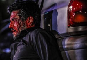 Sina Mehrad Instagram - ‎حامد ، ایستاد ، جنگید ، خسته شد ، زخمی عمیق جسم و روحش را شرحه شرحه کرد... اما هرگز زانو نزد 
‎ حامد در آخرین قدم هایش آرزو میکرد در ناکجا آبادی به راضیه بپیوندد ، اما زنده ماند ، او ادامه خواهد داد ،  در قصه ای دیگر 
دیر یا زود ...
.
‎سپاس از حامد عنقا و بهرنگ توفیقی که فرصت ماندن و ادامه دادن را از حامد دریغ نکردند
عکس : محمد دارایی