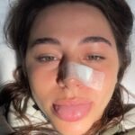 Sky Katz Instagram - surf board- 1 sky- 0 (tw: blood)
