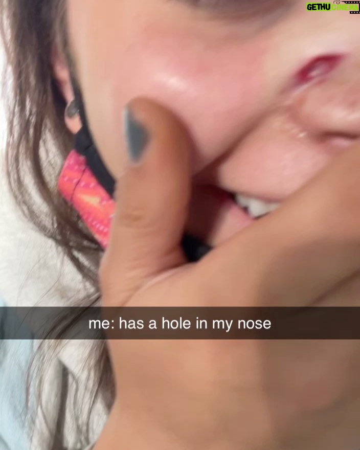 Sky Katz - 169.5K Likes - surf board- 1
sky- 0
(tw: blood)
