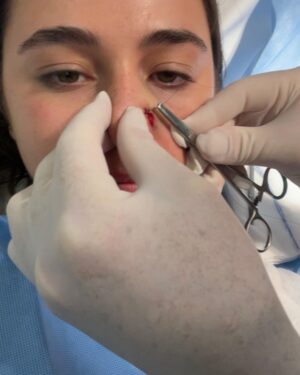 Sky Katz Instagram - surf board- 1
sky- 0
(tw: blood)