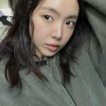 Son Na-eun Instagram - 눈다래끼시절🩹