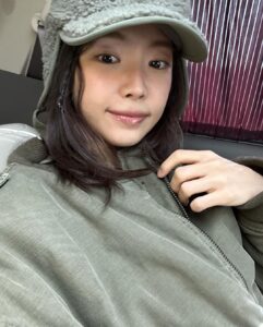 Son Na-eun Instagram - 눈다래끼시절🩹