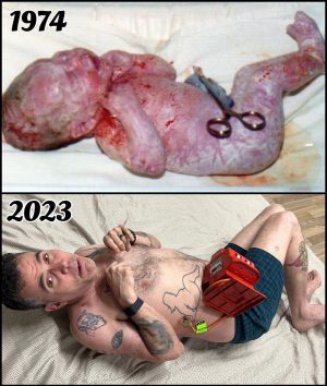 Steve-O Instagram - The top photo is me being born in London, England, and the bottom photo is me officially announcing my return to the UK! Swipe for my tour dates, and hit the link in my bio to have access to presale tickets before everyone else when they go live Wednesday, April 26th at 9am! Yeah dude!!!