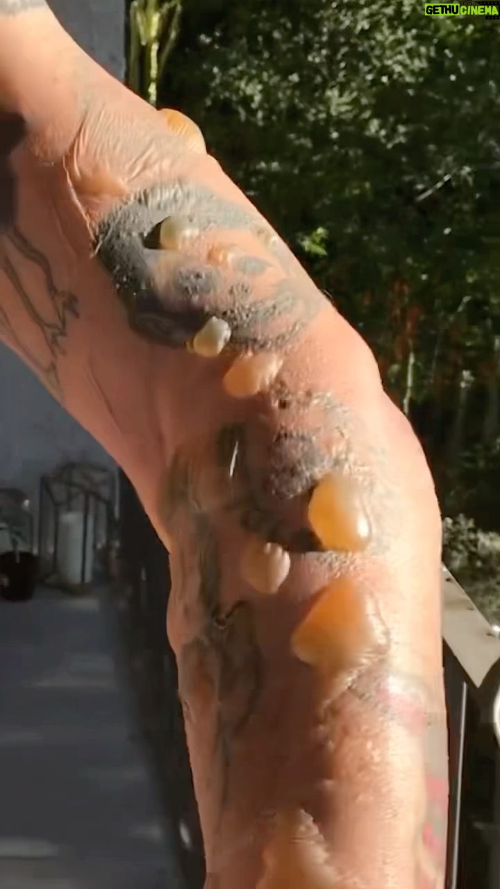 Steve-O - 177.4K Likes - The most horrific pain I’ve ever been in…