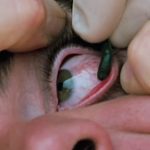 Steve-O Instagram - The old leech on the eyeball trick!